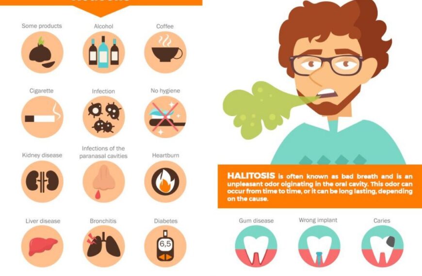 Halitosis (Mouth Odor)