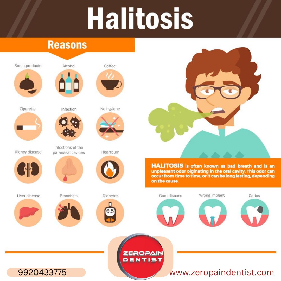 Halitosis (Mouth Odor)